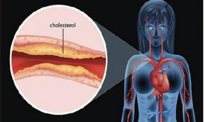 শরীরের খারাপ কোলেস্টেরল কমাবে যেসব পানীয়